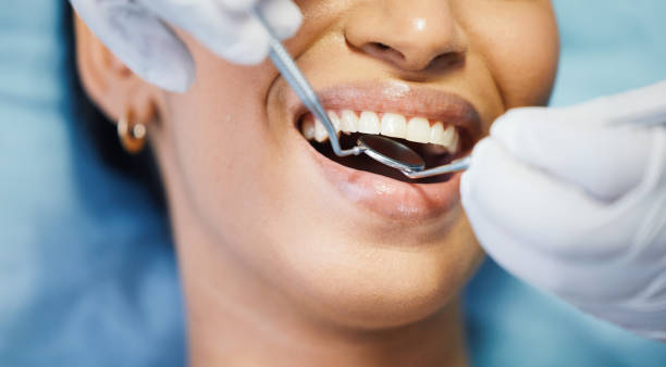 Best Tooth Infection Emergency Dentist  in Brookings, SD