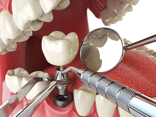 Emergency Gum Pain Relief in SD